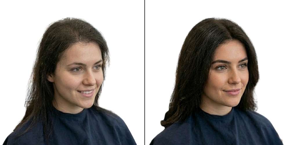 Hair Treatment
