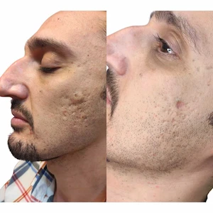 Before-and-after